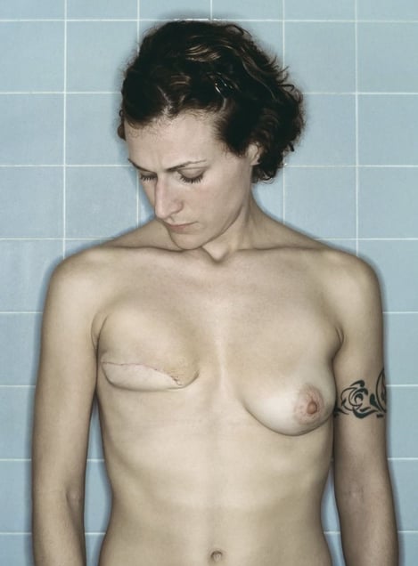 Self-Portrait, Post-Mastectomy III, 12.2005