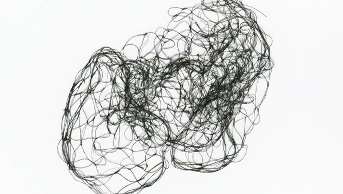 Foetal Attraction II © Elaine Duigenan