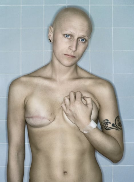 Self-Portrait, Chemo 7th Cycle IV, 04.2006