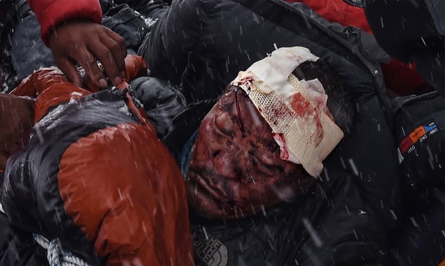 A man suffering from severe head trauma is bundled in a sleeping bag used asa makeshift stretcher while being taken by rescuers to a medical tent moments after the avalanche in Nepal, 25 April 2015.