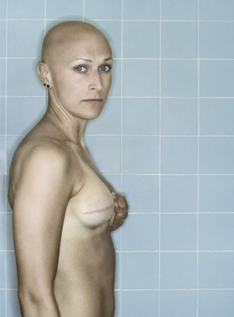 Self-Portrait, Chemo 4th Cycle V, 03.2006