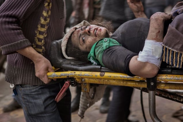 A woman injured by Syrian government shelling lies wounded on a stretcher outside of a field hospital in the Shaar district of Aleppo on February 10, 2013. © Nish Nalbandian