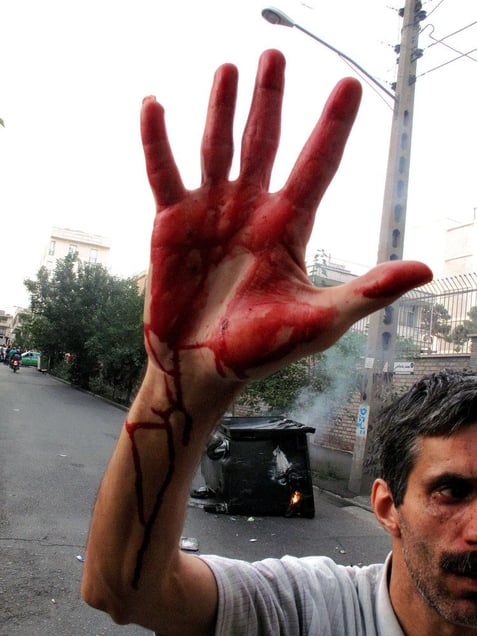 A man with the blood of Neda Agha-Soltan on his hand, after she was shot during a demonstration in which supporters of Irans defeated presidential candidate Mir Hossein Mousavi clashed with Basij Members. Thousands defied an ultimatum from supreme leader Ayatollah Ali Khamenei for an end to protests over the disputed presidential election. Tehran, IRAN - June 20, 2009
© Copyright 1979-2009 Alfred Yaghobzadeh. All rights reserved.