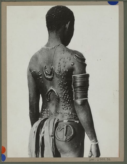 Tattoo "embroidered" on the back of a native. Body ornamentation obtained by scarification, 1935 © Quai Branly