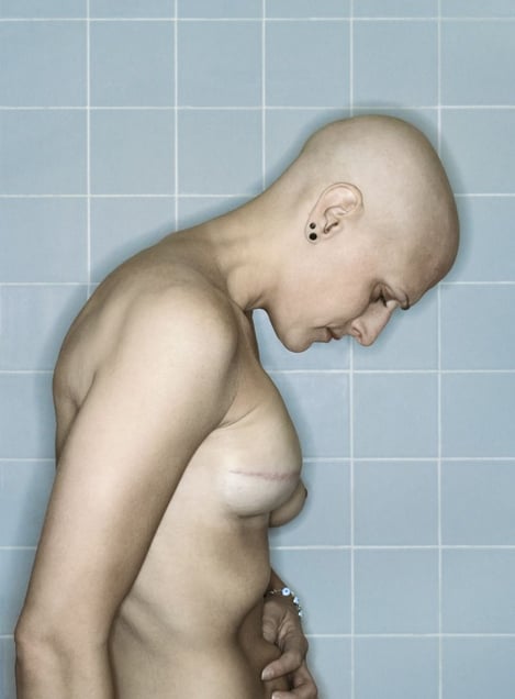 Self-Portrait, Chemo 5th Cycle II, 03.2006