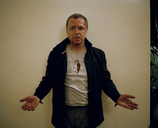 bloodied hunter with recovered bullet, kalahari, northern cape, south africa-from the series 'hunters'-David Chancellor