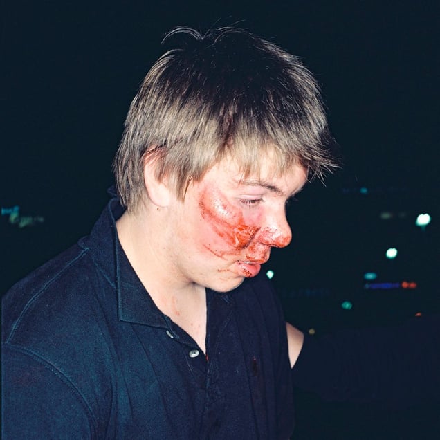 Second beating that night, 03.15  from the series BATTERED (2006-2007). © Harri Pälviranta