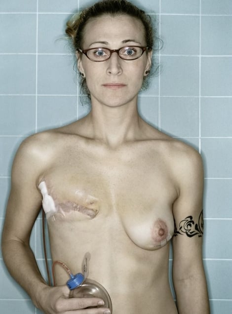 Self-Portrait, Post-Mastectomy I, 12.2005