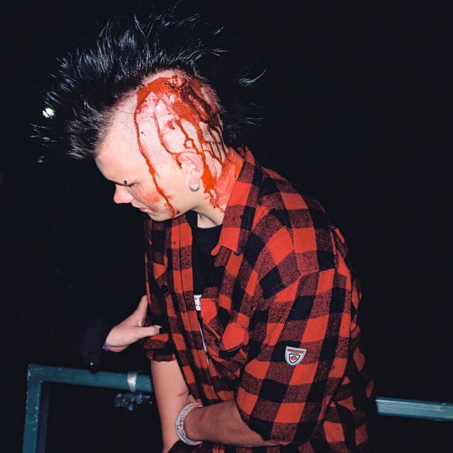 Hit with a bottle, 02.35  from the series BATTERED (2006-2007). © Harri Pälviranta