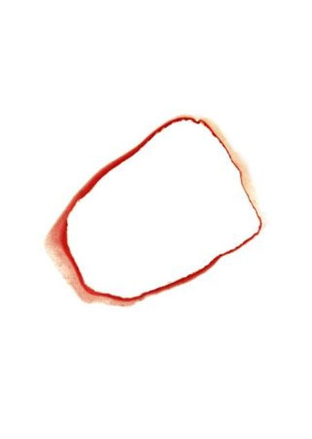 Hemogram S.B. 25-8-98, 1998, C-print, 120 x 80 cm © Joan Fontcuberta