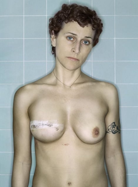 Self-Portrait, Post-Reconstruction II, 12.2006
