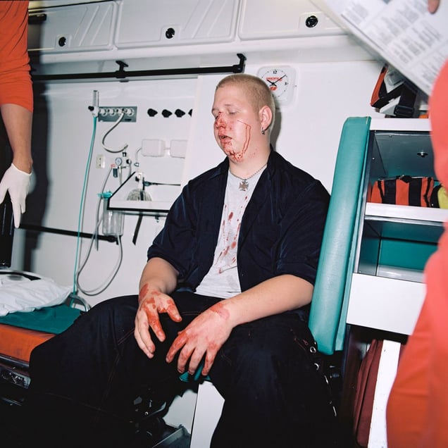 A broken nose, 23.40  from the series BATTERED (2006-2007). © Harri Pälviranta