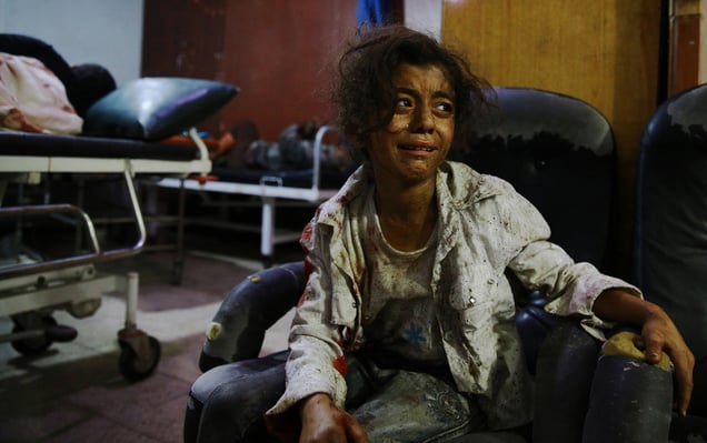 A wounded Syrian girl cries at a makeshift hospital in the rebel-held area of Douma, Syria, 12 August 2015.