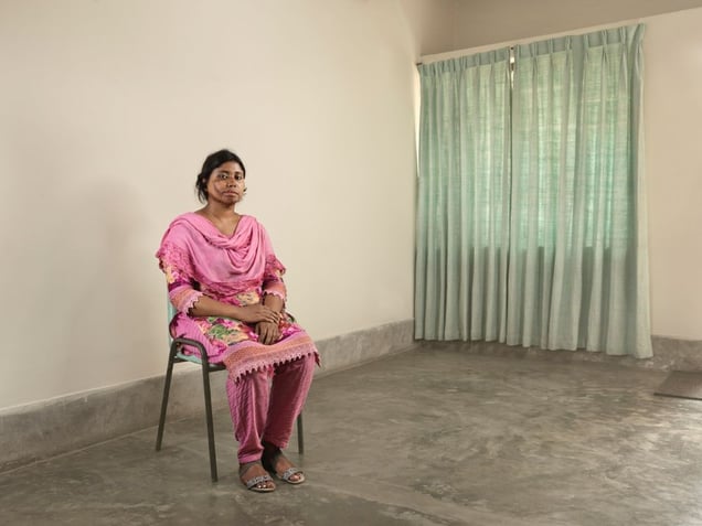 Every year people in Bangladesh are disfigured beyond recognition by acid attacks. The victims are literally scarred for life. A striking series of photos and a documentary that emphasizes the resilience of the mutilated victims © Ken Hermann, Denmark. Finalist, Portraiture, Professional Competition. 2014 Sony World Photography Awards