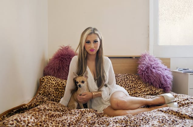 Martha, 24 years. Lip Fillers. From the series "In My Skin" © Michelle Sank