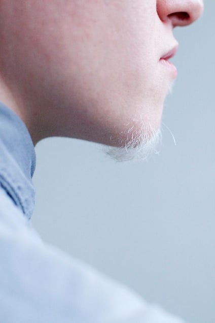 A DIFFERENT LOOK - a closer look on albinism. (ANDERS KIJKEN)