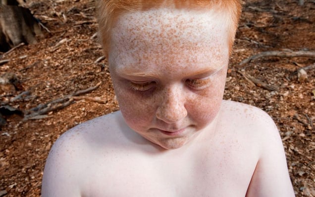 Jordy, from the series Natural Red Hair © Hanne van der Woude